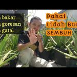 Manfaat Lidah Buaya Untuk Luka Bakar Ringan Panduan Lengkap Perawatan Alami