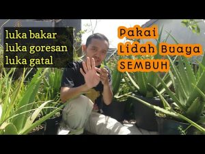 Manfaat Lidah Buaya Untuk Luka Bakar Ringan Panduan Lengkap Perawatan Alami